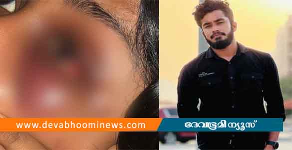 ഇന്‍സ്റ്റഗ്രാമില്‍ അശ്ലീലസന്ദേശം അയച്ചു; ചോദ്യം ചെയ്ത യുവതിക്ക് നടുറോഡില്‍ ക്രൂരമര്‍ദനം