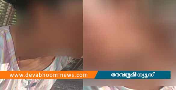 കുഞ്ഞിന് പാല് നല്‍കിയില്ലെന്ന് ആരോപിച്ച് 19കാരിക്ക് ക്രൂരമര്‍ദനം